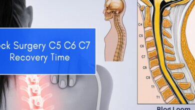 neck surgery c5-c6-c7 recovery time