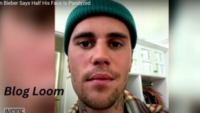 justin bieber paralyzed